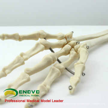 JOINT11 (12358) Medizinische Anatomie Mensch Oberarm Skelettmodelle, Gelenkarm Skelettmodell